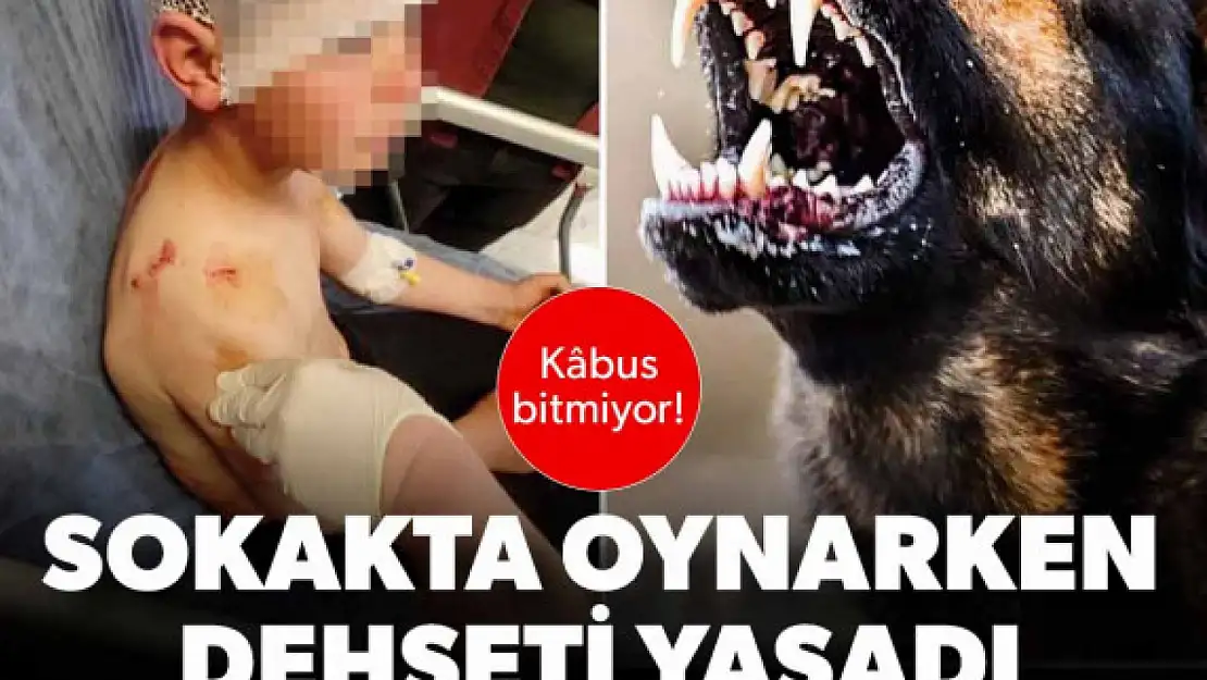 Yine sahipsiz köpek saldırısı: Dokuz yaşındaki çocuğa saldırdı