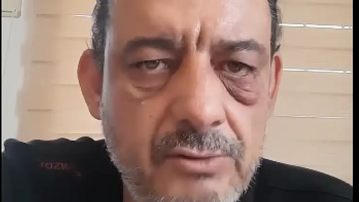 Canbey'den, Gazeteci Sataroğlu'na Yapılan Saldırıya Tepki:  'Şiddetle Kınıyoruz'